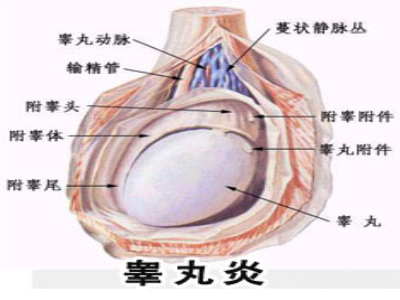 導致睪丸炎的原因有哪些